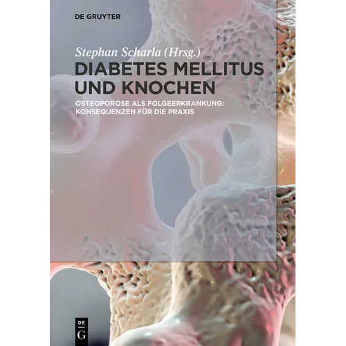 Diabetes Mellitus Und Knochen: Osteoporose ALS Folgeerkrankung: Konsequenzen Für Die PRAXIS