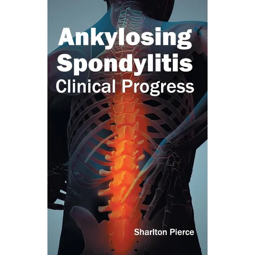 Ankylosing Spondylitis: Clinical Progress