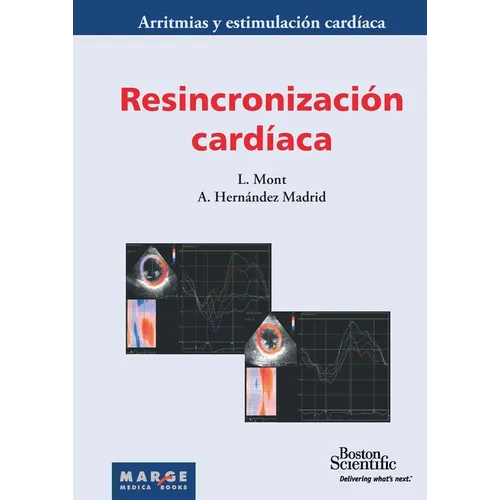 Resincronización cardíaca