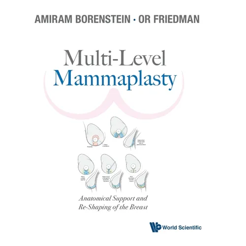 Multi-Level Mammaplasty