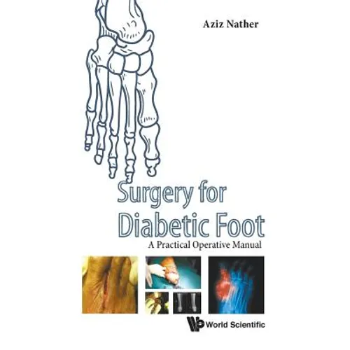Surgery for Diabetic Foot