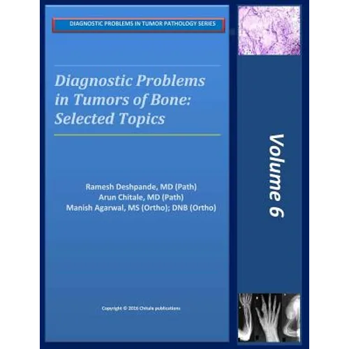Diagnostic Problems in Bone Tumors: Selected Topics