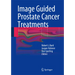 Image Guided Prostate Cancer Treatments