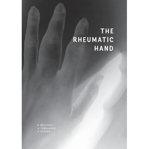 The Rheumatic Hand