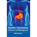 Gastric Carcinoma: Advances and Management