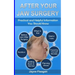 After Your Jaw Surgery: Practical and Helpful Information You Should Know