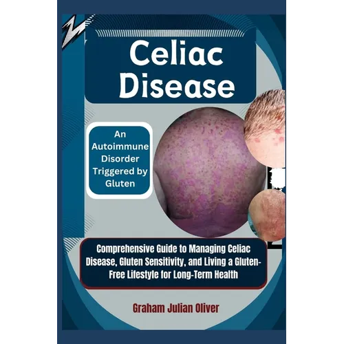 Celiac Disease: An Autoimmune Disorder Triggered by Gluten: Comprehensive Guide to Managing Celiac Disease, Gluten Sensitivity, and Li