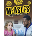 Measles: How a Contagious Rash Changed History