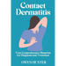 Contact Dermatitis: Your Comprehensive Blueprint for Diagnosis and Treatment