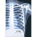 X-Ray