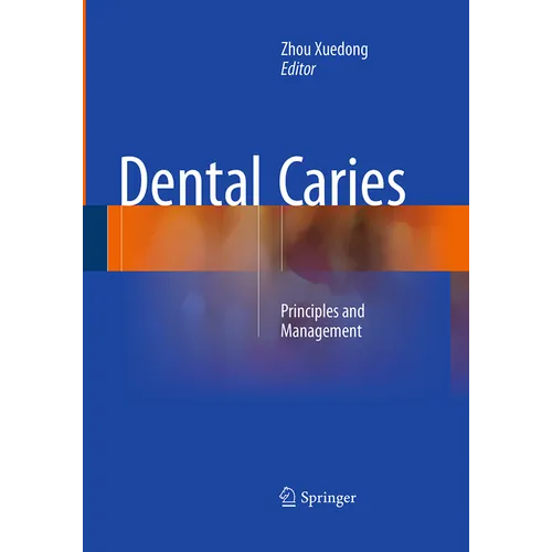 Dental Caries: Principles and Management