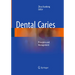 Dental Caries: Principles and Management