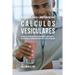 80 Recetas de Comidas Y Jugos Para Prevenir Cálculos Vesiculares: Use Una Dieta Apropiada y Hábitos Nutricionales Inteligentes Para Reducir Sus Chance