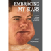 Embracing My Scars: A journey of hope in the face of adversity