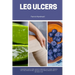 Leg Ulcers: A Beginner's Quick Start Guide to Managing Leg Ulcers Through Diet and Other Natural Methods, With Sample Recipes and a 7-Day Meal Plan