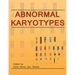 Abnormal Karyotypes