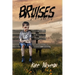 Bruises