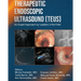 Therapeutic Endoscopic Ultrasound (TEUS)