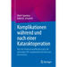 Komplikationen Während Und Nach Einer Kataraktoperation: Von Der Phakoemulsifikation Über Die Sekundäre Iol-Implantation Bis Hin Zum Kernverlust