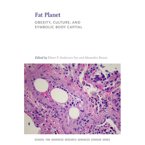 Fat Planet: Obesity, Culture, and Symbolic Body Capital