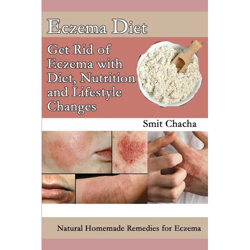 Eczema Diet - Get Rid of Eczema with Diet, Nutrition and Lifestyle Changes: Natural Homemade Remedies for Eczema
