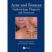 Acne and Rosacea: Epidemiology, Diagnosis and Treatment