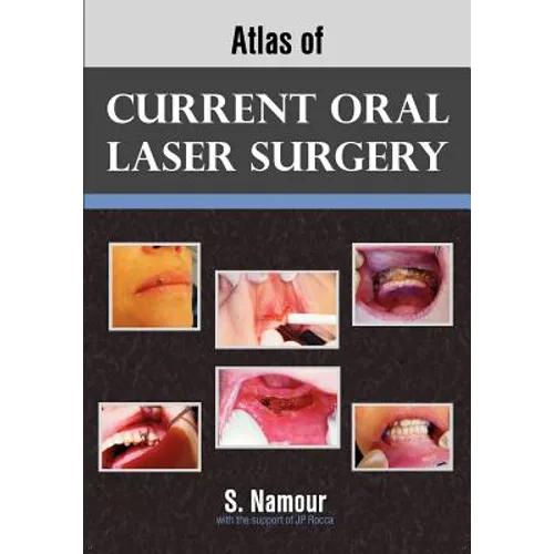 Atlas of Current Oral Laser Surgery