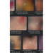 Sensitive Anatomy