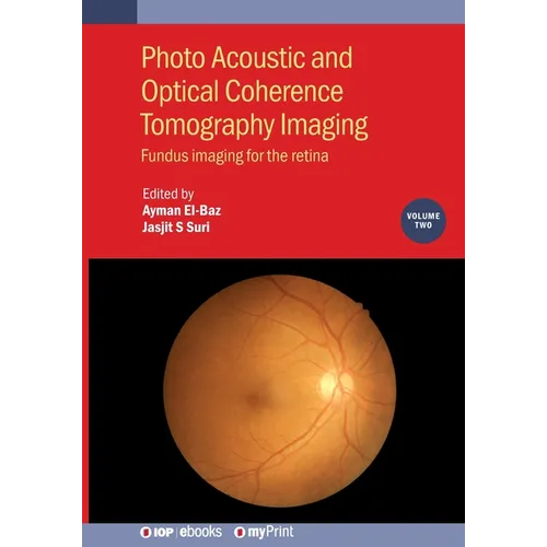 Photo Acoustic and Optical Coherence Tomography Imaging, Volume 2: Fundus imaging for the retina
