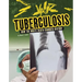 Tuberculosis: How the White Death Changed History
