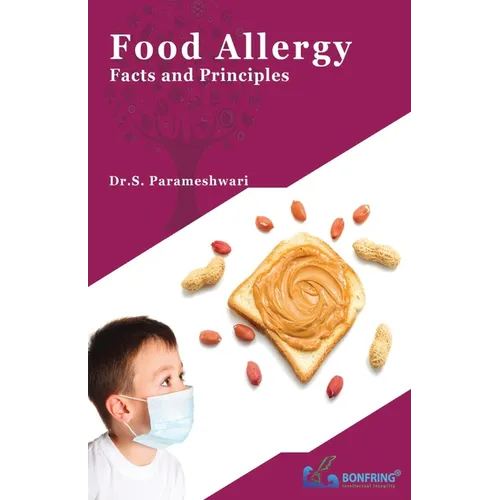 Food Allergy-Facts and Principles
