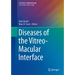 Diseases of the Vitreo-Macular Interface