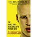 The Bones and Resilience of a Person with Albinism