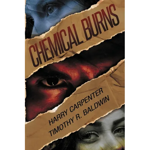 Chemical Burns