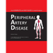 Your Complete and Easy Guide to Understanding Peripheral Artery Disease