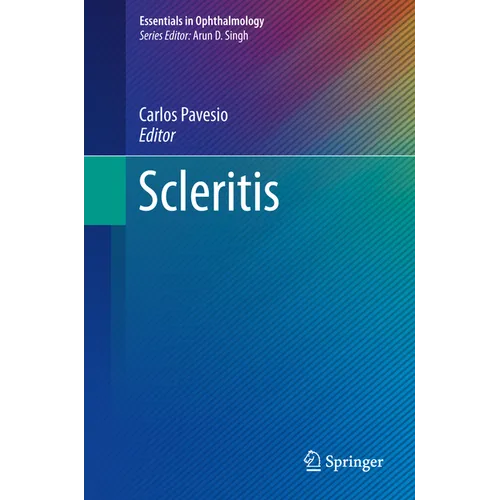Scleritis