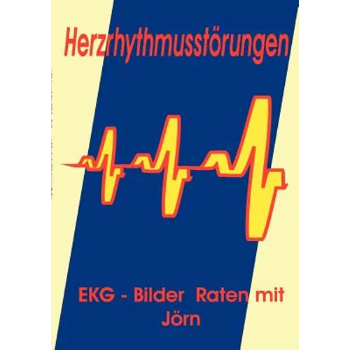 Herzrhythmusstörungen: EKG - Bilder Raten mit Jörn