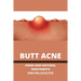 Butt Acne: Home And Natural Treatments For Folliculitis: Barber'S Itch Home Remedies