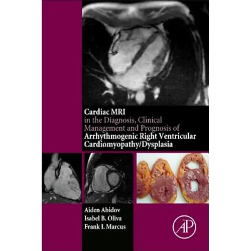 Cardiac MRI in Diagnosis, Clinical Management, and Prognosis of Arrhythmogenic Right Ventricular Cardiomyopathy/Dysplasia