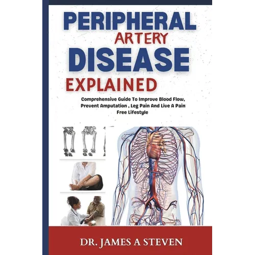 peripheral Artery Disease Explained: Comprehensive Guide To Improve Blood Flow, Prevent Amputation, Leg Pain And Live A Pain Free Lifestyle