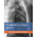 Tuberculosis: Edicion Especial. Tomo I