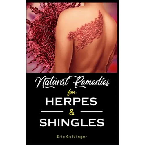 Natural Remedies For HERPES & SHINGLES: The Complete Guide