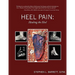 Heel Pain: Healing the Heel