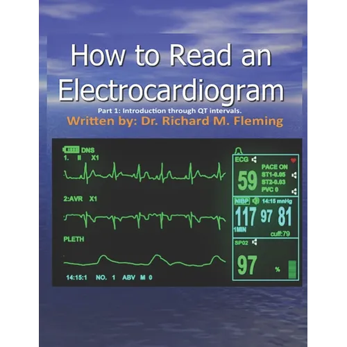 How to Read an Electrocardiogram.