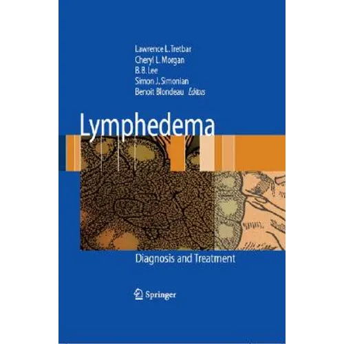 Lymphedema: Diagnosis and Treatment