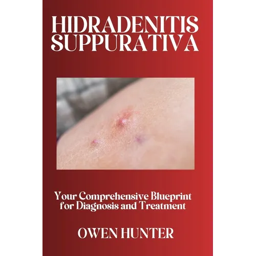 Hidradenitis Suppurativa: Your Comprehensive Blueprint for Diagnosis and Treatment