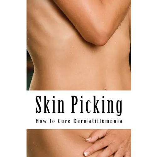 Skin Picking: How to Cure Dermatillomania