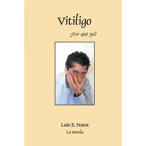 Vitiligo