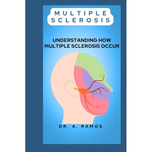 Multiple Sclerosis: Understanding How Multiple Sclerosis Occur