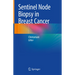 Sentinel Node Biopsy in Breast Cancer